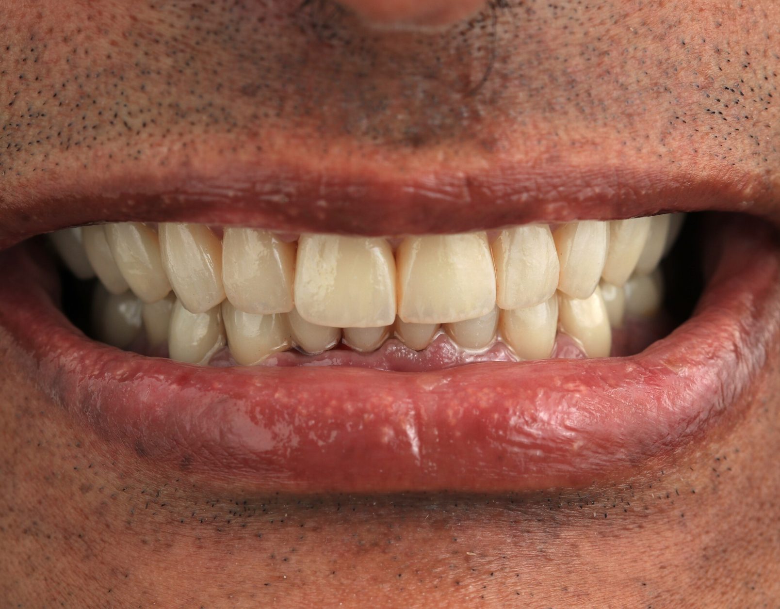 Himanshu Desai after